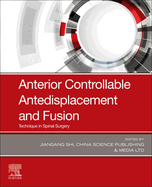 Anterior Controllable Antedisplacement and Fusion: Technique in Spinal Surgery