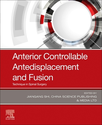 Anterior Controllable Antedisplacement and Fusion: Technique in Spinal Surgery - Shi, Jiangang (Editor), and China Science Publishing & Media Ltd