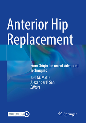 Anterior Hip Replacement: From Origin to Current Advanced Techniques - Matta, Joel M (Editor), and Sah, Alexander P (Editor)