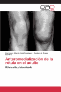 Anteromedializacion de La Rotula En El Adulto