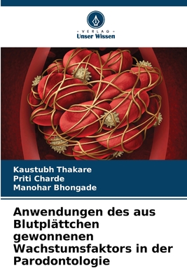 Anwendungen des aus Blutpl?ttchen gewonnenen Wachstumsfaktors in der Parodontologie - Thakare, Kaustubh, and Charde, Priti, and Bhongade, Manohar