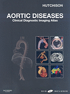 Aortic Diseases: Clinical Diagnostic Imaging Atlas