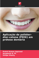 Aplicao de politer-ter-cetona (PEEK) em prtese dentria