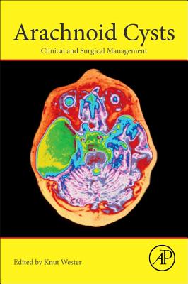 Arachnoid Cysts: Clinical and Surgical Management - Wester, Knut (Editor)