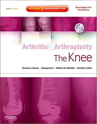 Arthritis and Arthroplasty: The Knee: Expert Consult - Online, Print and DVD - Brown, Thomas E., MD, and Cui, Quanjun, and Mihalko, William M.