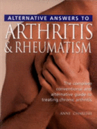 Arthritis and Rheumatism - Alternative