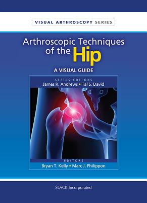 Arthroscopic Techniques of the Hip: A Visual Guide - Kelly, Bryan T, MD, and Philippon, Marc J