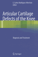 Articular Cartilage Defects of the Knee: Diagnosis and Treatment