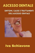 Ascesso Dentale: Sintomi, Cause E Trattamenti Dell'ascesso Dentale