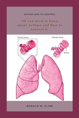Asthma and its control: All you need to know about Asthma and how to control it. - Kline, Ronald M