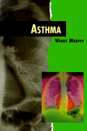 Asthma