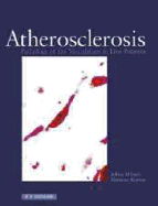 Atherosclerosis: Pathology of the Vasculature in Live Patients