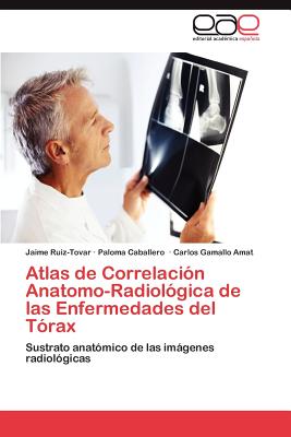 Atlas de Correlacion Anatomo-Radiologica de Las Enfermedades del Torax - Ruiz-Tovar Jaime, and Caballero Paloma, and Gamallo Amat Carlos