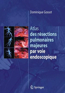 Atlas Des Resections Pulmonaires Majeures Par Voie Endoscopique