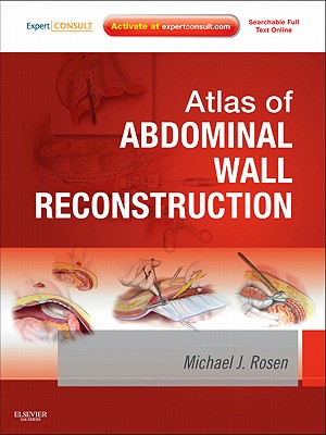 Atlas of Abdominal Wall Reconstruction - Rosen, Michael J.