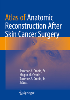 Atlas of Anatomic Reconstruction After Skin Cancer Surgery - Cronin, Sr, Terrence A. (Editor), and Cronin, Megan M. (Editor), and Cronin, Jr., Terrence A. (Editor)