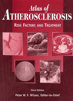 Atlas of Atherosclerosis: Risk Factors and Treatment - Wilson, Peter W F (Editor)