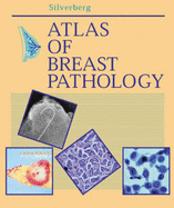 Atlas of Breast Pathology