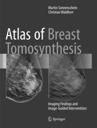 Atlas of Breast Tomosynthesis: Imaging Findings and Image-Guided Interventions