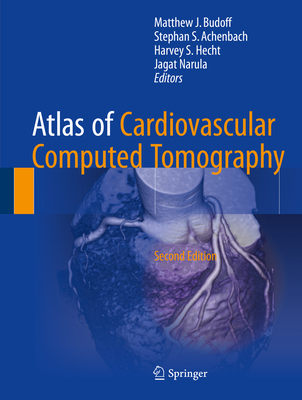 Atlas of Cardiovascular Computed Tomography - Budoff, Matthew J (Editor), and Achenbach, Stephan S (Editor), and Hecht, Harvey S, M.D. (Editor)