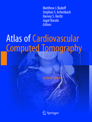 Atlas of Cardiovascular Computed Tomography - Budoff, Matthew J (Editor), and Achenbach, Stephan S (Editor), and Hecht, Harvey S, M.D. (Editor)