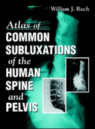 Atlas of Common Subluxations of the Human Spine and Pelvis - Ruch, William J