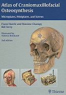 Atlas of Craniomaxillofacial Osteosynthesis: Microplates, Miniplates, and Screws