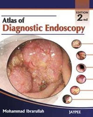 Atlas of Diagnostic Endoscopy - Ibrarullah, Mohammad