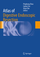 Atlas of Digestive Endoscopic Resection