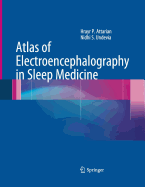 Atlas of Electroencephalography in Sleep Medicine