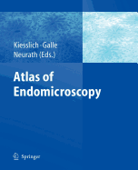 Atlas of Endomicroscopy