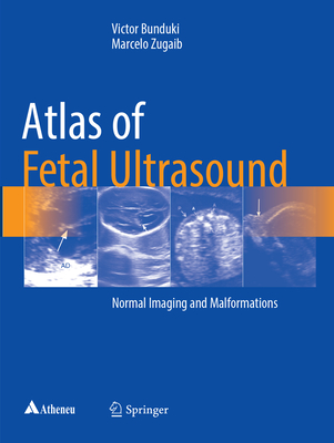 Atlas of Fetal Ultrasound: Normal Imaging and Malformations - Bunduki, Victor, and Zugaib, Marcelo