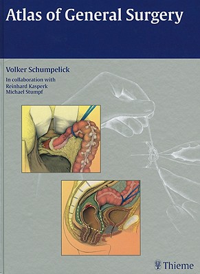 Atlas of General Surgery - Schumpelick, Volker