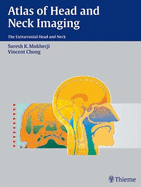 Atlas of Head and Neck Imaging: The Extracranial Head and Neck