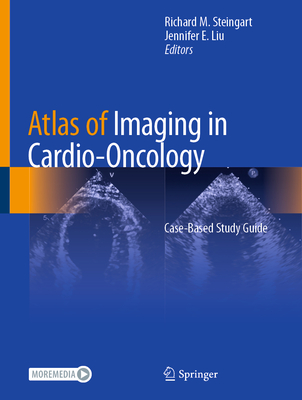 Atlas of Imaging in Cardio-Oncology: Case-Based Study Guide - Steingart, Richard M (Editor), and Liu, Jennifer E (Editor)