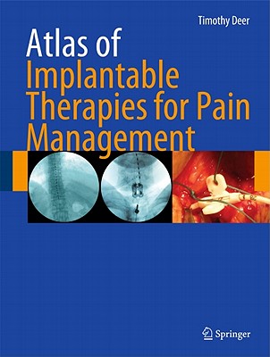 Atlas of Implantable Therapies for Pain Management - Deer, Timothy R