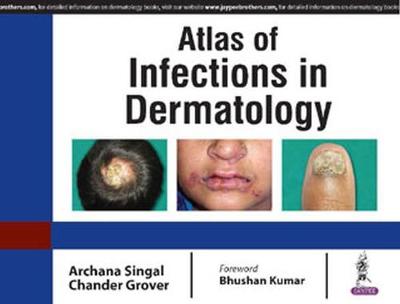 Atlas of Infections in Dermatology - Singal, Archana, and Grover, Chander