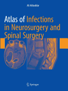 Atlas of Infections in Neurosurgery and Spinal Surgery