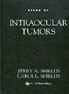 Atlas of Intraocular Tumors - Shields, Jerry A, Dr., MD, and Shields, Murrell G, and Shields, Carol L, Dr., MD