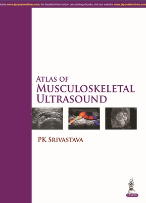 Atlas of Musculoskeletal Ultrasound - Srivastava, PK