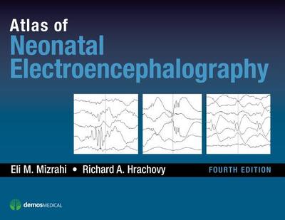 Atlas of Neonatal Electroencephalography - Mizrahi, Eli M., and Hrachovy, Richard A.