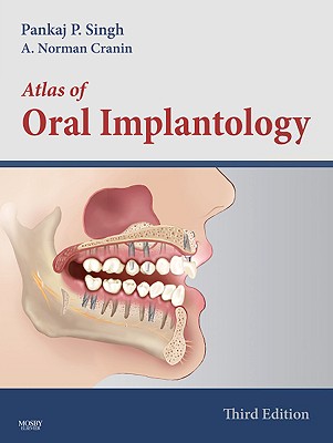 Atlas of Oral Implantology - Singh, Pankaj, Dds, and Cranin, A Norman, Dds