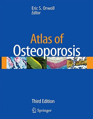 Atlas of Osteoporosis - Orwoll, Eric S (Editor)