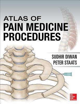 Atlas of Pain Medicine Procedures - Diwan, Sudhir, and Staats, Peter