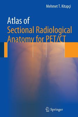 Atlas of Sectional Radiological Anatomy for Pet/CT - Kitapci, Mehmet T