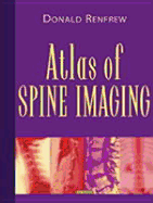 Atlas of Spine Imaging