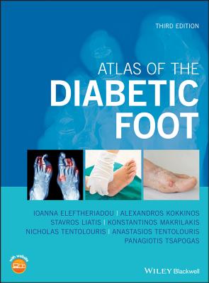 Atlas of the Diabetic Foot - Eleftheriadou, Ioanna, and Kokkinos, Alexandros, and Liatis, Stavros