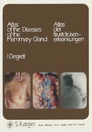 Atlas of the Diseases of the Mammary Gland =: Atlas Der Brustdrusenerkrankungen