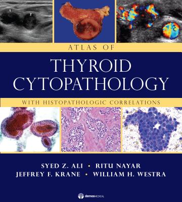 Atlas of Thyroid Cytopathology: With Histopathologic Correlations - Ali, Syed Z, MD, and Nayar, Ritu, MD, and Krane, Jeffrey F, MD, PhD