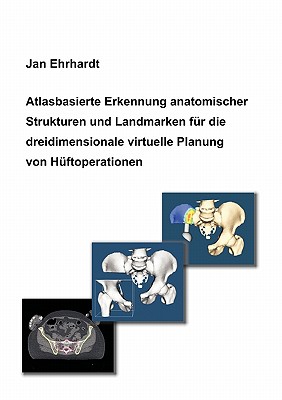 Atlasbasierte Erkennung anatomischer Strukturen und Landmarken f?r die dreidimensionale virtuelle Planung von H?ftoperationen - Ehrhardt, Jan